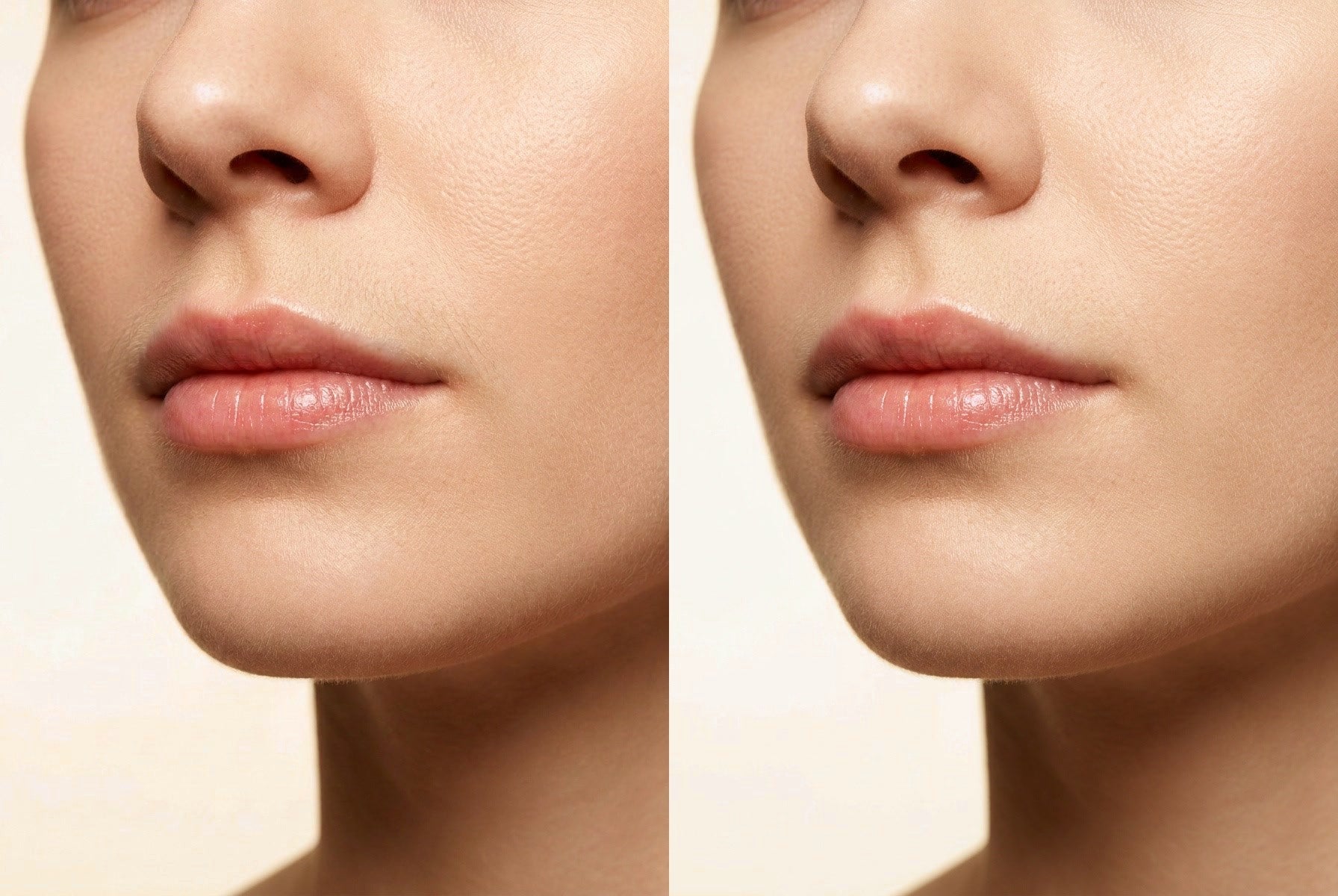 Face: before on the left, after on the right