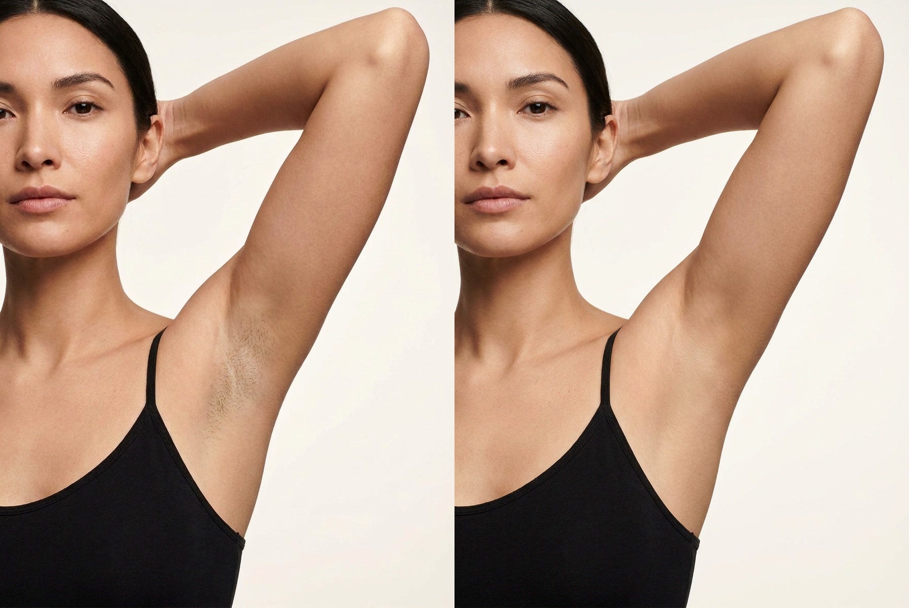 Underarms: before on the left, after on the right